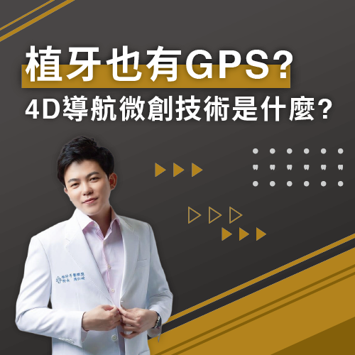 植牙也有GPS? 4D導航微創技術是什麼?